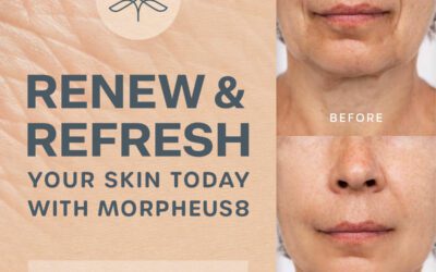 Morpheus8: A Revolutionary Solution for Skin Rejuvenation at Reimagine Beauty Med Spa