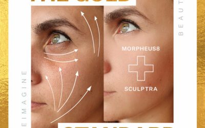 The Gold Standard: Morpheus8 & Sculptra