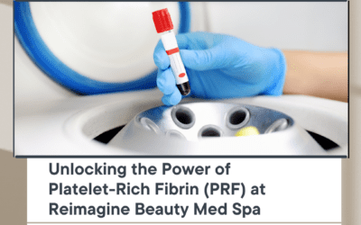 Unlocking the Power of Platelet-Rich Fibrin (PRF) at Reimagine Beauty Med Spa