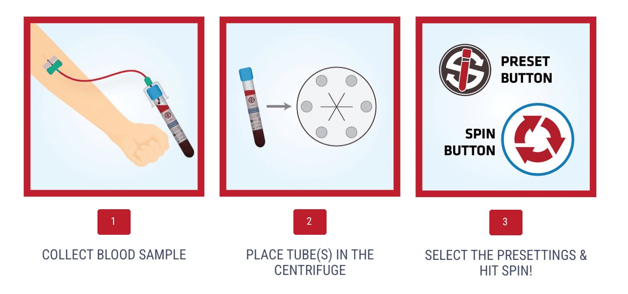 PRF process explanation