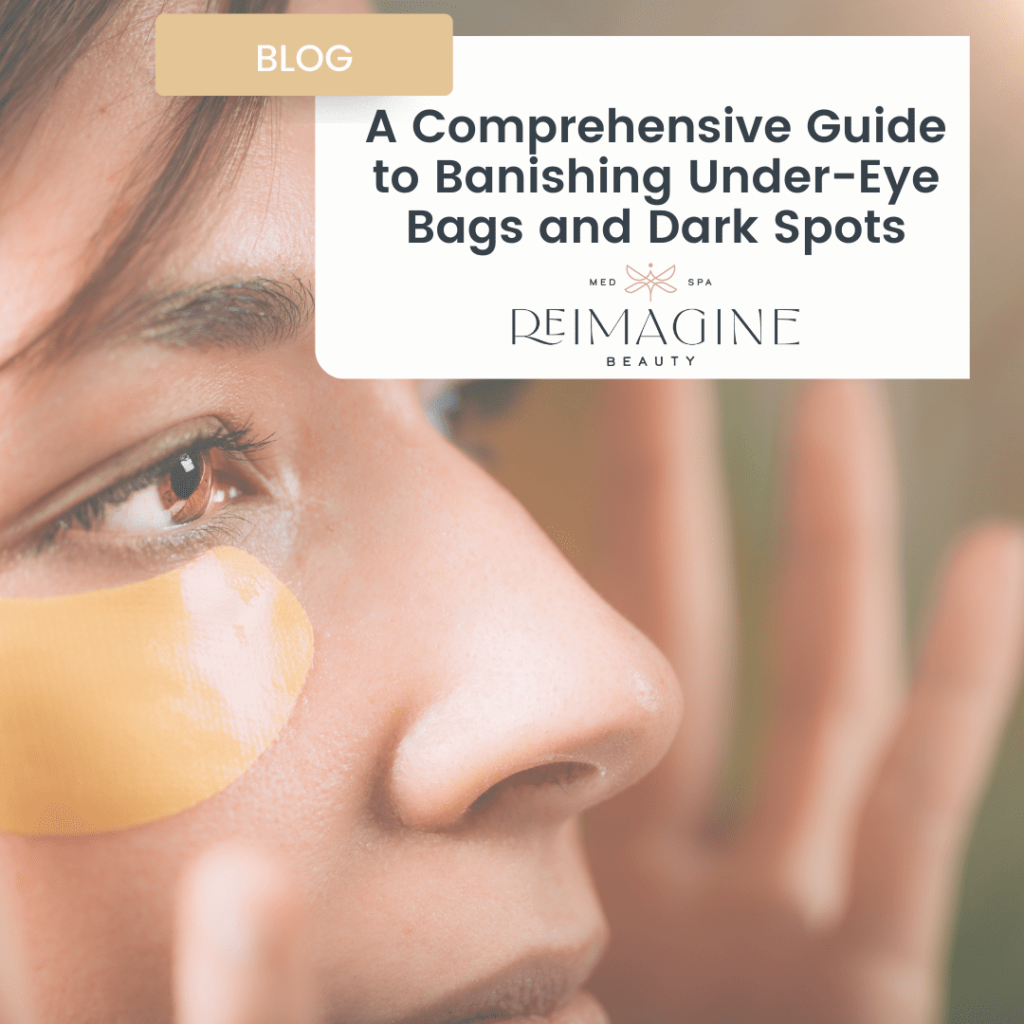 Banishing Under-Eye Bags and Dark Spots