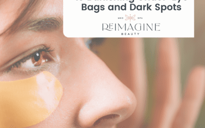 A Comprehensive Guide to Banishing Under-Eye Bags and Dark Spots