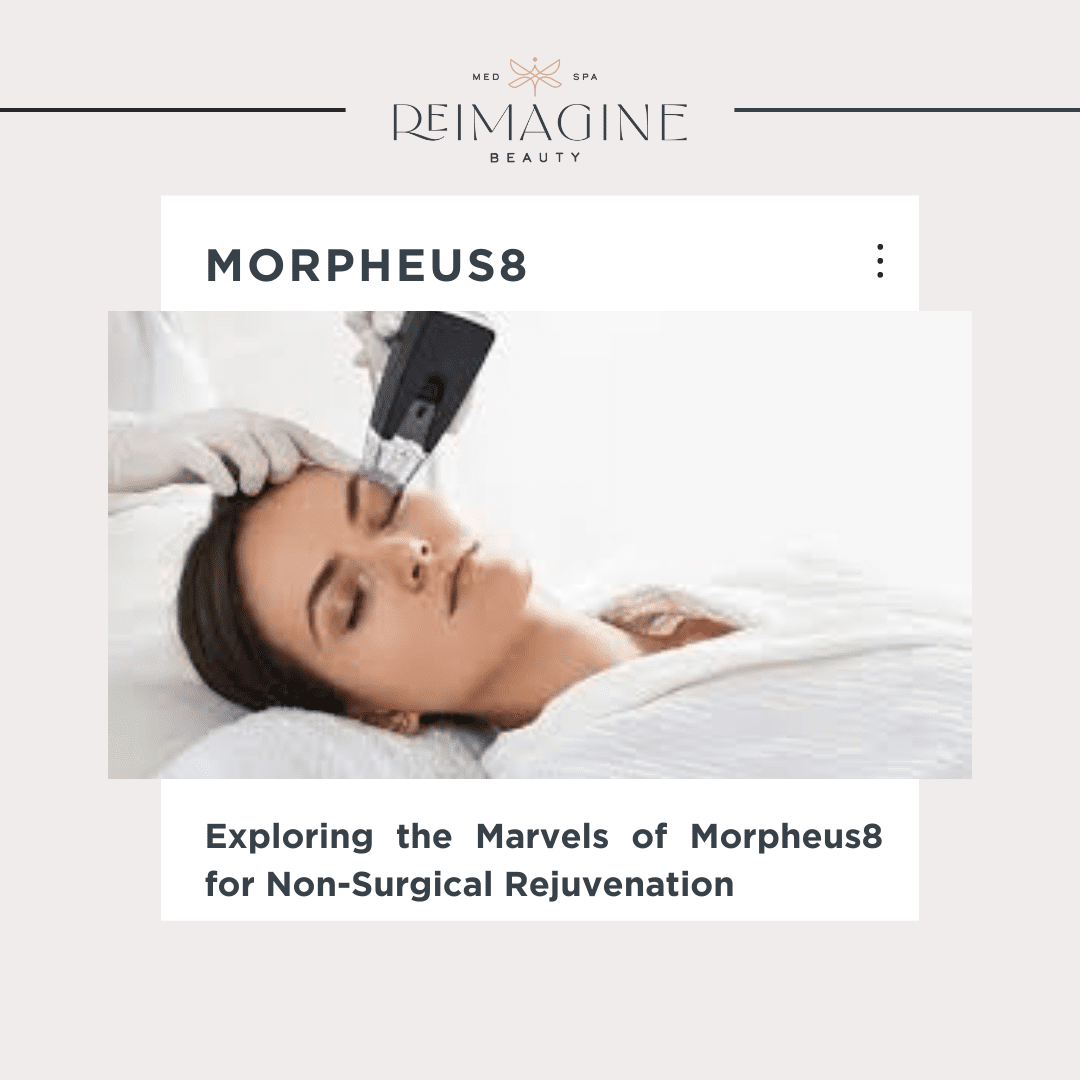 a woman lying down receiving Morpheus8 treatment