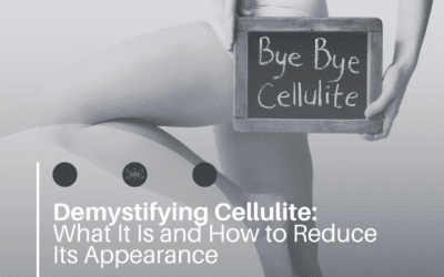 Demystifying Cellulite: What It Is and How to Reduce Its Appearance