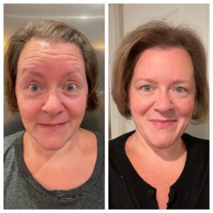 Reimagine Beauty before and After