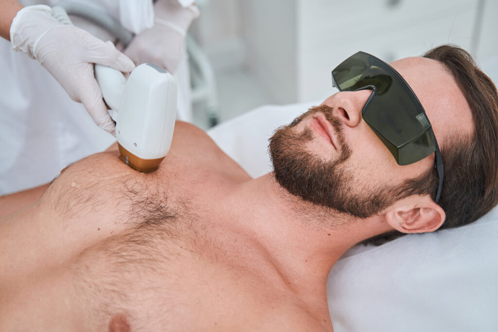 Male client wearing safety goggles receiving a non-invasive laser hair removal treatment at Reimagine Beauty Lancaster Med Spa.